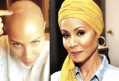 Health Condition: Jada Pinkett-Smith on Alopecia, Shaving Her Head and the Slap Heard Around the World