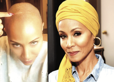 Health Condition: Jada Pinkett-Smith on Alopecia, Shaving Her Head and the Slap Heard Around the World