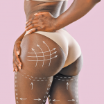 Why Brazilian Butt Lift Procedure is Popular — And Dangerous