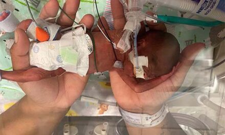 Curtis Means, Alabama boy weighing less than a pound at birth, is world’s most premature surviving baby