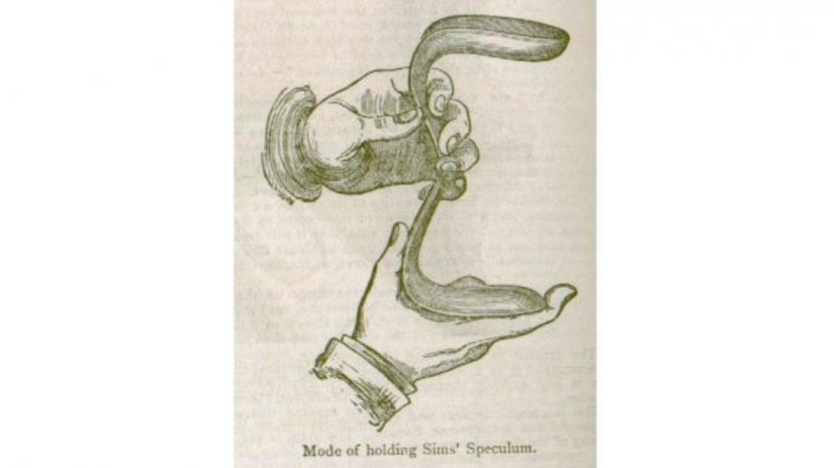 Sims Speculum. (Credit: Public Domain)