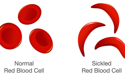 National Sickle Cell Awareness Month- do you know your status?