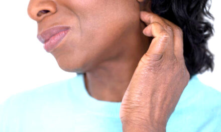 Resisting the Itch: Tips for Overcoming the Urge to Scratch Itchy Skin