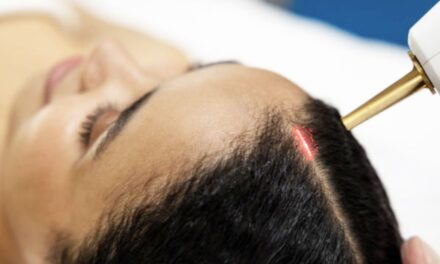 Does Low-Level Light Therapy Work For Alopecia?