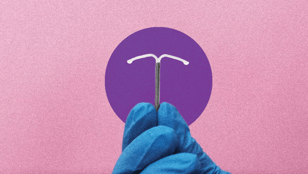 CDC Updates IUD Placement Guidelines to Address Pain and Trauma