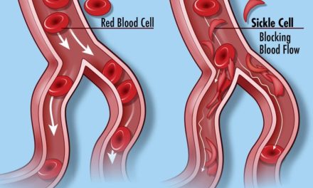 Addressing sickle cell disease: The importance of genetic counseling