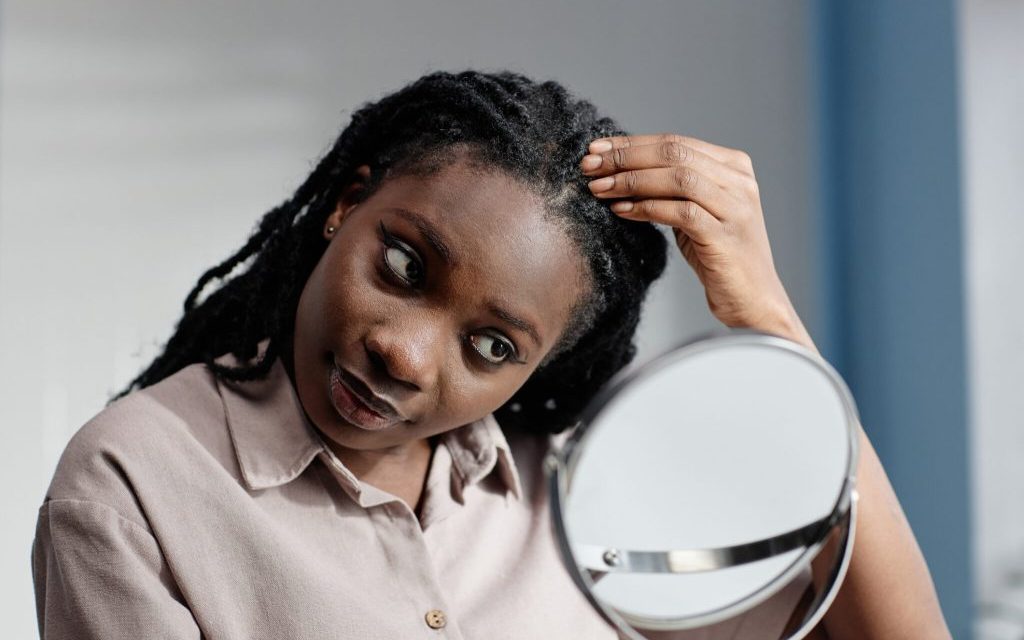 6 Foods that Cause Dandruff