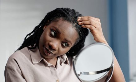 6 Foods that Cause Dandruff