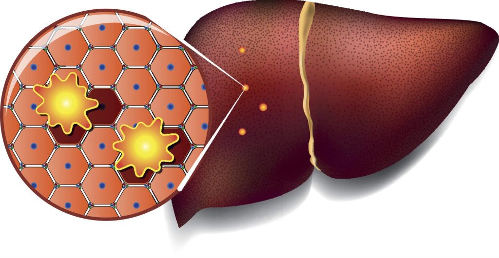 7 Foods That Replenish Your Liver