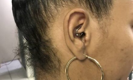 My Story: I Tried This To Stop My Migraines…This Worked