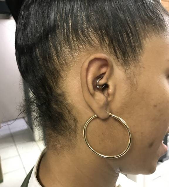 My Story: I Tried This To Stop My Migraines…This Worked