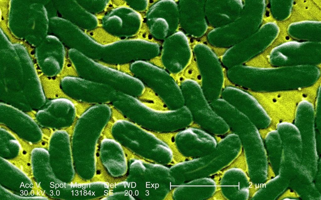 Florida Reports Four Deaths from Flesh-Eating Bacteria—Who Is at Risk?