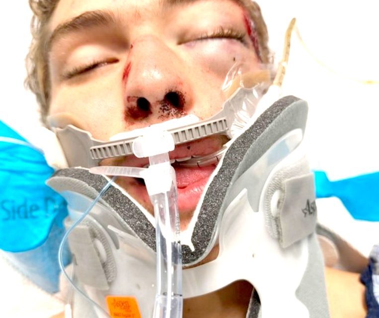 Officials Rule Deshler Teen’s Injuries a “Tragic Accident,” No Charges Filed