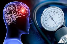 How High Blood Pressure Can Damage Your Brain
