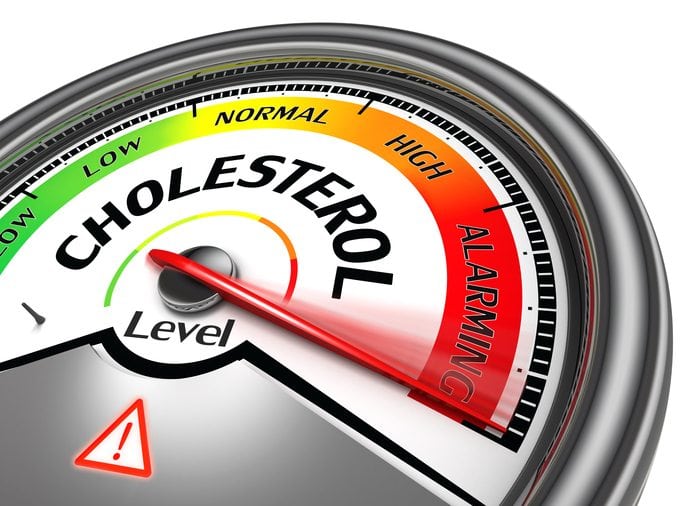 What Do Cholesterol Numbers Really Mean? Breaking Down the Lab Results That Matter