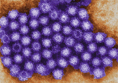 Norovirus Cases Surge Early Across U.S., Alabama Among States Seeing Increased Activity 