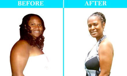 How One Woman Eliminated 50 Fibroids Without Surgery
