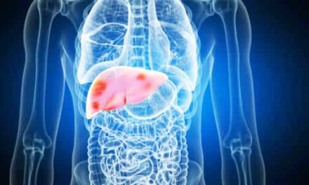 Doctors Warn: 5 Reasons to Skip Popular Liver Detox Programs