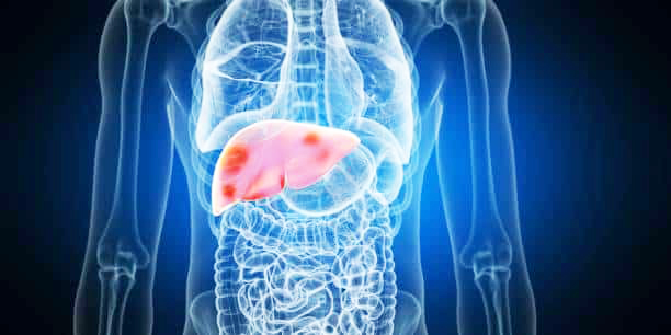Doctors Warn: 5 Reasons to Skip Popular Liver Detox Programs