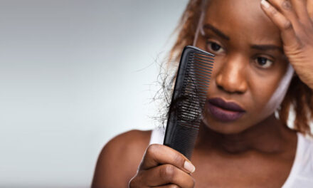 Can Diabetes Cause Hair Loss? The Surprising Connection Explained