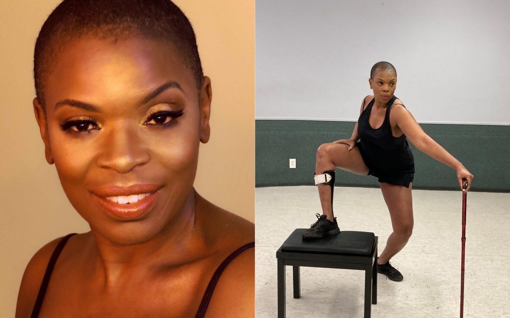 Brain tumor survivor reclaims her life, reshapes art and advocacy beyond disability