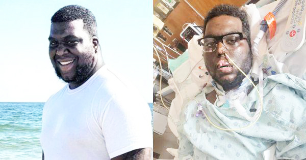 Routine Dental Visit Turns Life-Altering:Texas Father Loses Limbs After Severe Infection